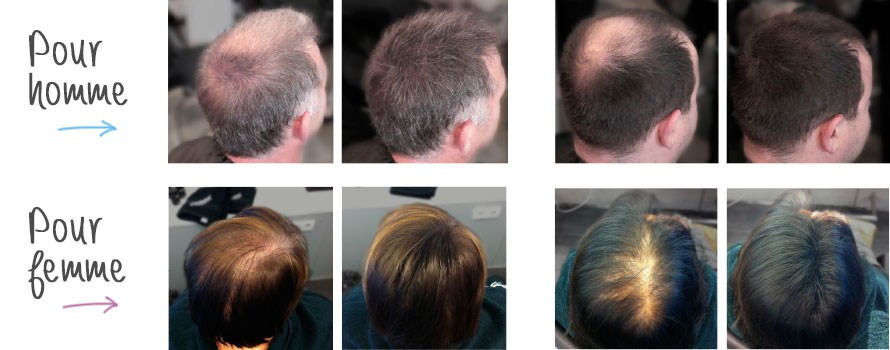 Poudre Cheveux densifiante HAIR PLUS à base de plantes - Hairvisual
