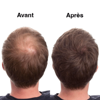 hair plus recharge de poudre densifiante à base de plantes